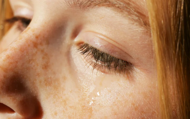 THE SCIENCE BEHIND PERMANENT FRECKLE REMOVAL: WHAT EXPERTS SAY