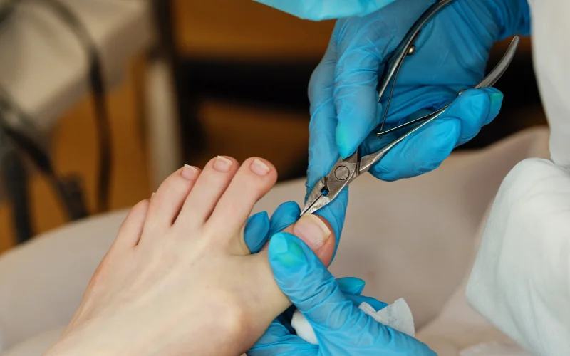 Long-Term Treatments for Toenail Fungus